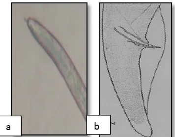 Gambar 4. Nematoda  R.similis betina (a) (Perbesaran 100X), nematoda R. similis jantan (b) (Dropkin, 1992)