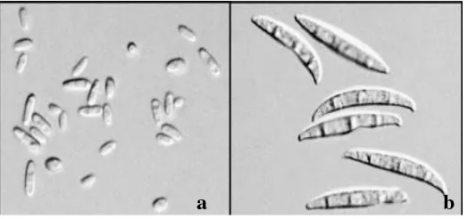 Gambar 1 : Koloni F. oxysporum f.sp cubense: a. mikrokonidia, b. Makrokonidia       Sumber: Fourie et al (2011) 