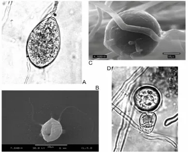 Gambar 1. Phytophthora sp. A : Sporangia. B : Zoospora. C: Chlamidospora. D.Oospora 