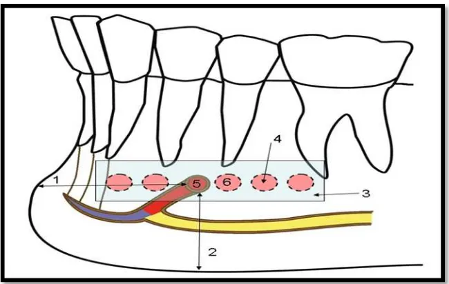 Gambar 3. Anatomi variasi posisi foramen mentale pada bidang horizontal dalam hubungannya dengan akar gigi