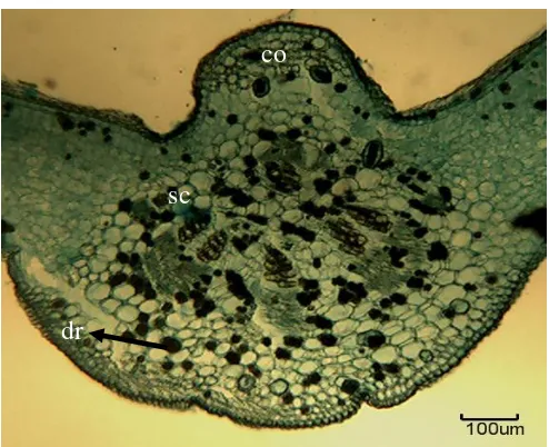 Figure 11: TS of leaf margin of T. dichotomum. Scale = 100 µm   