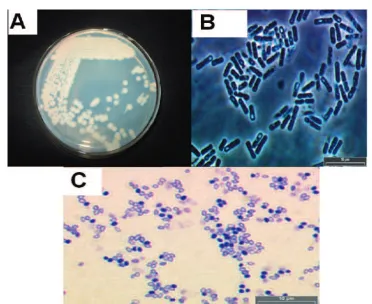 Figure 2. Experiment to show the motility of BtReX02.