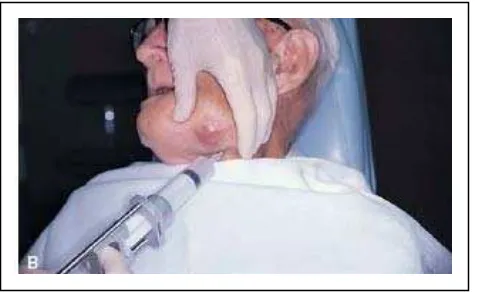Gambar 3.12  Pasien usia 69 tahun setelah operasi menentukan sifat bengkak FNAB dilakukan