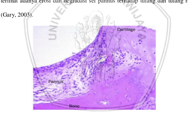 gambar jaringan sendi pada penderita penyakit AR menggunakan pewarnaan HE 