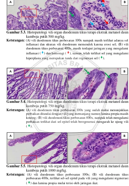 Gambar 5.5. Histopatologi vili organ duodenum tikus terapi ekstrak metanol daun kamboja putih 1000 mg/kg