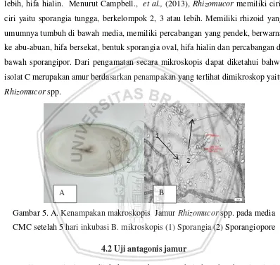 Gambar 5. A. Kenampakan makroskopis  Jamur Rhizomucor spp. pada media 