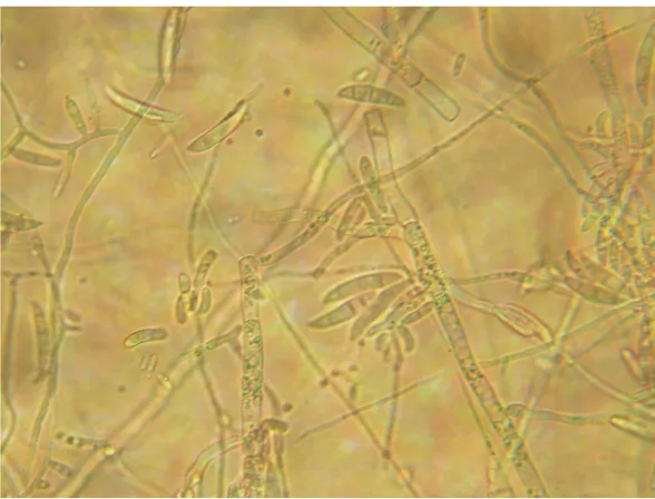 Gambar 3.1. Hasil Spora dari Fusarium oxysporum