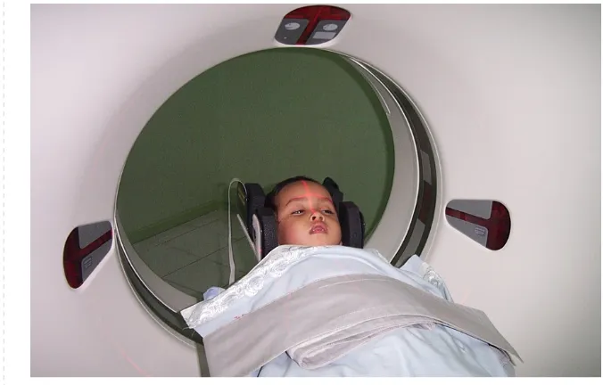 Gambar 2: CT Scan memastikan tidak terlihatnya kelainan fisik otak.