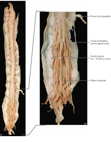 FIGURE 2C: Spinal Cord 4 — Cauda Equina (photograph)