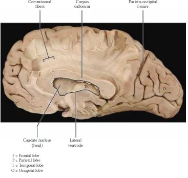 FIGURE 19A: Cerebral Hemispheres 9 — Medial Dissected View: Corpus Callosum (photograph)