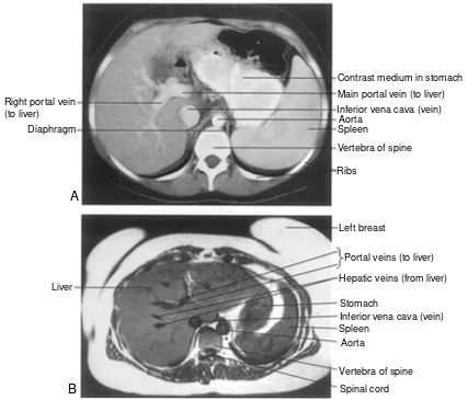 Figure 1-10Cross-sections in imaging. phy (CT) and Images taken across the body through the liver and spleen by (A) computed tomogra-(B) magnetic resonance imaging (MRI)