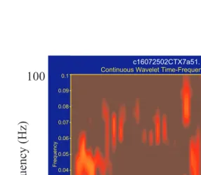 FIGURE 7.6 Sub- and suprathreshold neural activity in the vicinity of one M1 electrode duringone trial of skilled reaching