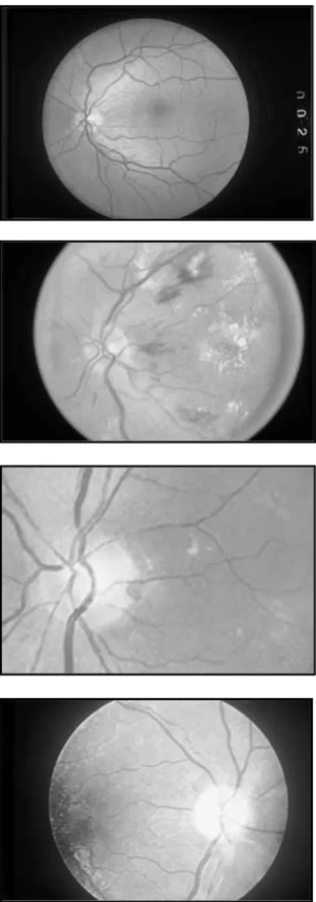 Figure 4-2. ■ Normal fundus. (From Dillon,