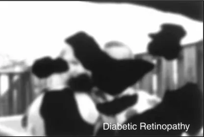 Figure 4-9. ■ Scene as it might be viewed by person with diabetic retinopathy. (From