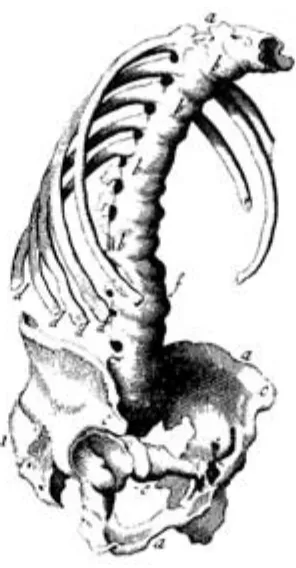 Figure 2 First representation of a skeleton with AS in itsﬁnal state by Bernard Conner, London, 1695.