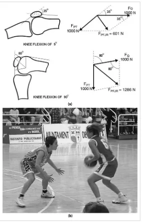 Figure 4.2. PFJR force determined for a knee flexion of 5knee flexion increases. Positions of maintained knee flexion are frequent in sports ° and 90° with a quadriceps muscular force of 1000N (a)