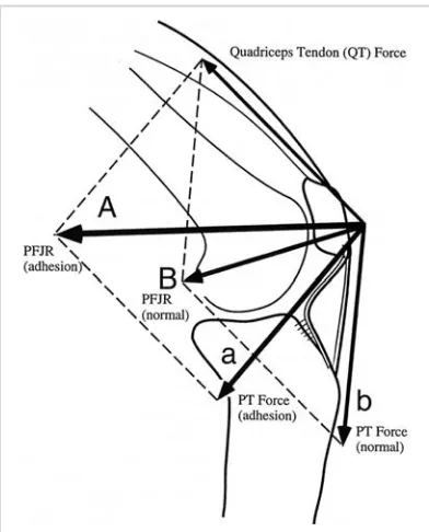 Figure 4.8. PFJR force (FPFJR) in a knee with patellar tendon adhesions tothe proximal tibial surface