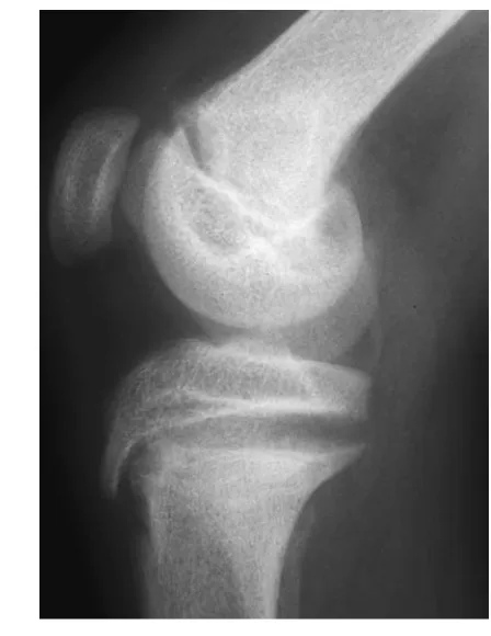 Figure C3.1.1