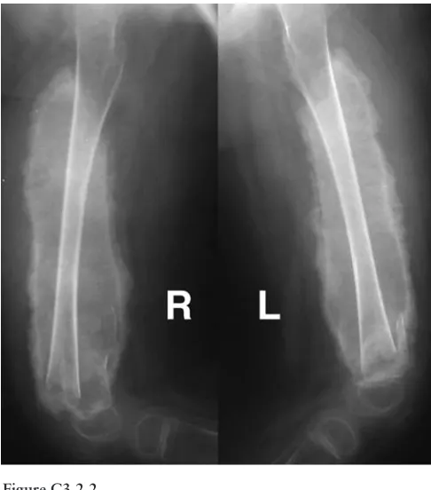 Figure C3.2.2