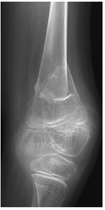 Figure C3.3.1