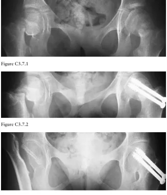 Figure C3.7.3