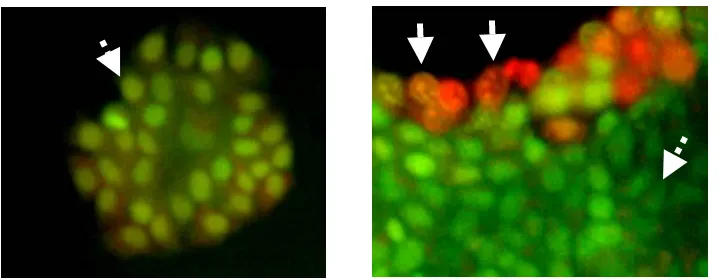 Gambar 3. Efek EP menginduksi apoptosis pada sel MCF-7 setelah 48 jam perlakuandengan sampel uji