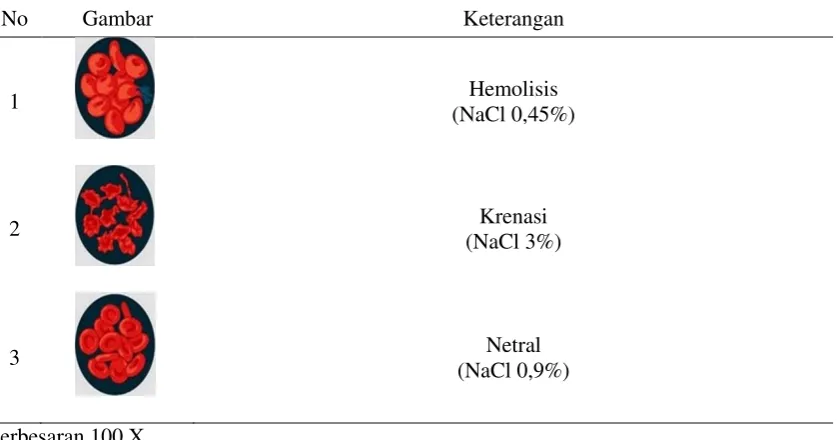 Gambar Keterangan 