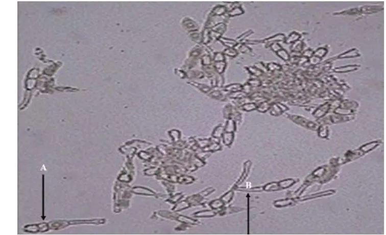 Gambar 1. Hialin teliospora dari Puccinia horiana (A) dan tangkai teliospora (B)(Szakuta dan Butrymowicz 2004).