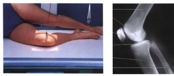 Gambar 6. Posisi pasien dan hasil radiograf proyeksi lateral(Ballinger, 2003).