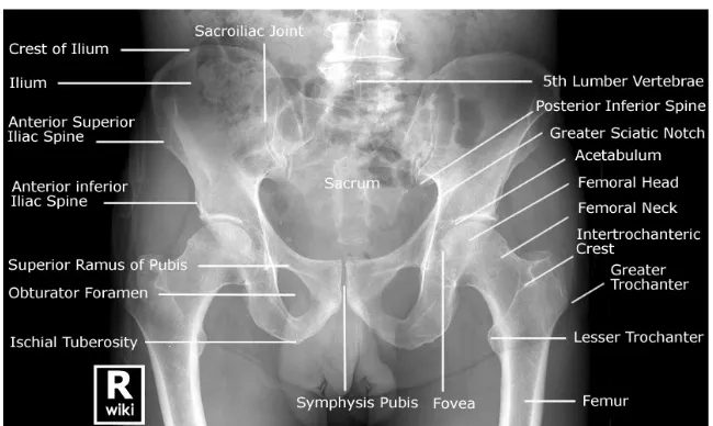 Gambar 9. Radiograf Pelvis AP wanita