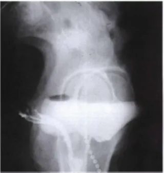 Gambar 2.11 Hasil radiograf proyeksi lateral (Merrill’s, 2010)