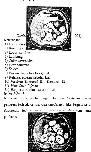 Gambar 2.7 Irisan Axial  3 (Bontrager, 2001)