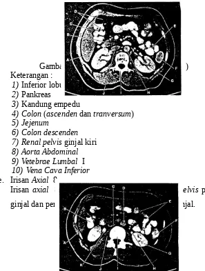 Gambar 2.9 Irisan Axial  7 (Bontrager, 2001)