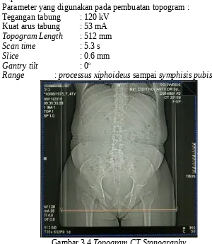 Gambar 3.4 Topogram CT Stonography