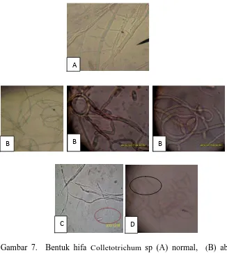 Gambar 7.  Bentuk hifa Colletotrichum sp (A) normal, (menggulung), (C) Lisis, (D) membengkok  