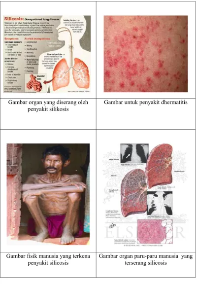 Gambar organ yang diserang oleh