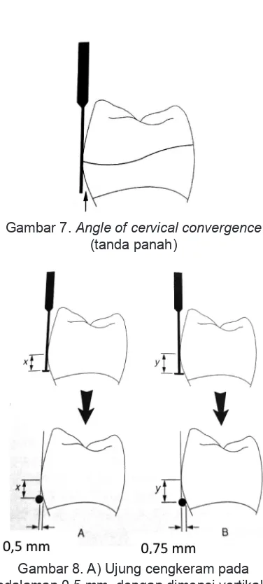 Gambar 7. Angle of cervical convergence 