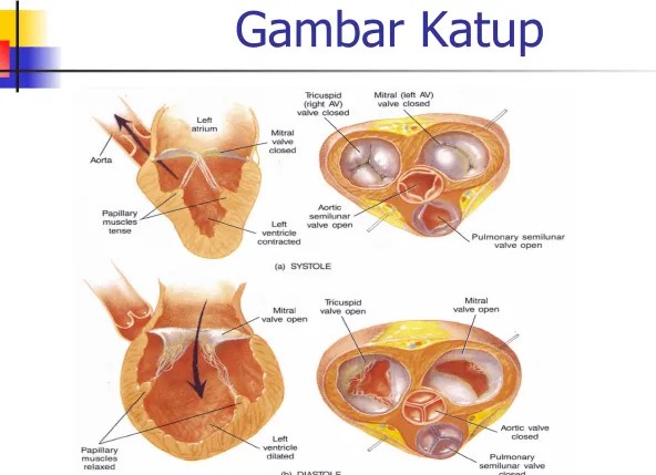 Gambar Katup