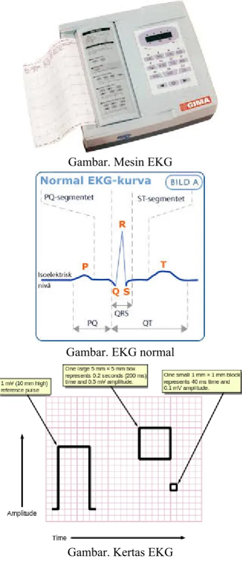Gambar. Mesin EKG