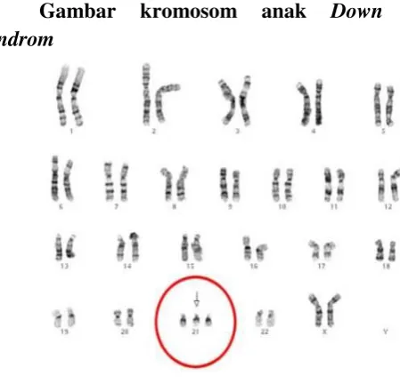 Gambar kromosom 