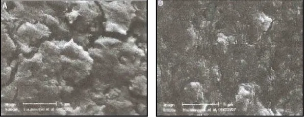 Gambar 4. (a) Smear layer pada permukaan saluran akar yang        diirigasi dengan air destilasi, (b) Smear layer  pada                 permukaan   saluran   akar  yang  diirigasi   dengan        NaOCl 5,25%.9  