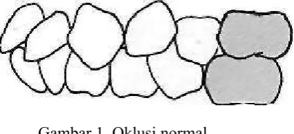 Gambar 1. Oklusi normal