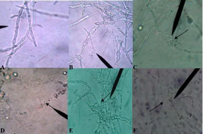 Gambar 4.7.1 (A) Hifa normal G. boninense pada media mineral tanpa koloidal kitin, (B) Dengan penambahan koloidal kitin