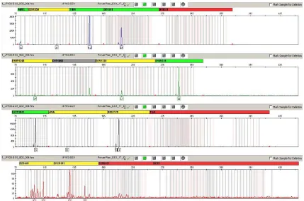 Fig. 2  Electropherogram of DNA typing results for sample 155 using PowerPlex® ESX 17 System (Promega) amplification kit