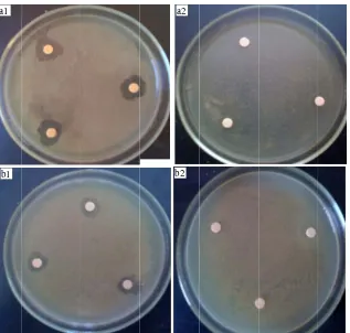 Fig. 3  Inhibgative controlsNegative contr. cus faecalis a1: Enterococcbition growth o ATof Gram positivTCC6538; a2: Nve bacteria in tNegative controlthe presence ofl; b1: Staphylocf the fraction 2coccus aureus A2 and their negATCC6538; b2: rol