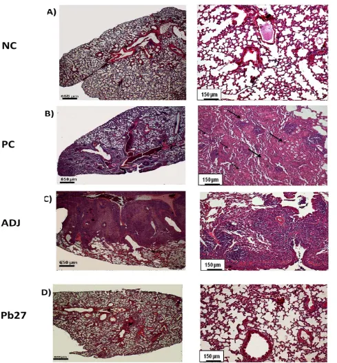 Fig. 2  Histological analysis of the lungs of mice subjected to 30 days of P. brasiliensisshown with low magnification (4follows: (NC) negative control (A), (PC) positive control (B), (ADJ) adjuvant (C), and (Pb27) immunized (D)
