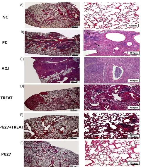 Fig. 3  Histological analysis of the lungs of mice subjected to 90 days of P. brasiliensisare as follows: (NC) negative control (A), (PC) positive control (B), (ADJ) adjuvant (C), (TREAT) treated (D), (TREAT + Pb27) immunized and treated (E), and (Pb27) im