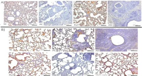 Fig. 4  Western blot of VEGF expression. Representative WB of the lung tissue homogenate shows VEGF expression, (A) 30  dpi and (B) 90 dpi