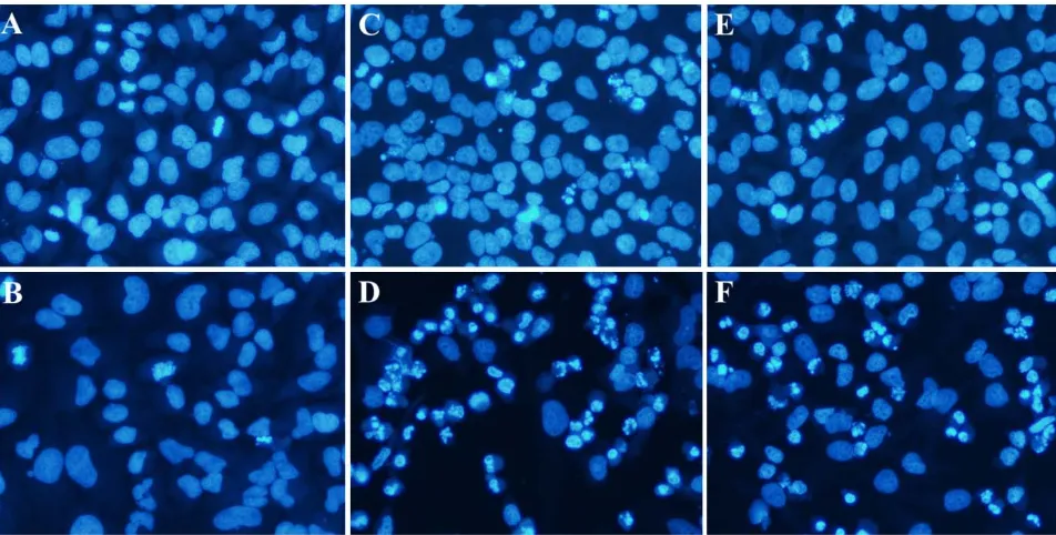 Fig. 2  Nuclear morphological changes in HeLa cells after being treated with DMSO 0.1% for 24 h (A) and 48 h (B), RME-5A 10 g/mL for 24 h (C) and 48 h (D) and RME-5B 10 g/mL for 24 h (E) and 48 h (F)