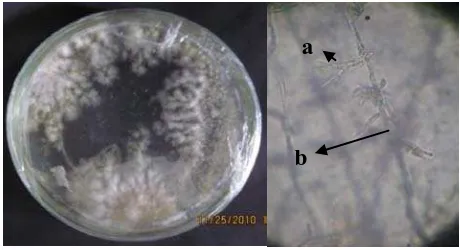 Gambar 6. Struktur makroskopis dan mikroskopis (Perbesaran 40 kali) genus Fusarium spp yang diisolasi dari serasah A